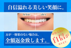 全額返金保証メニュー